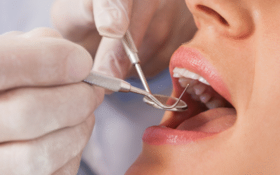 Smile Design in Barranquilla, Colombia: What You Really Need to Know